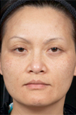 Patient # 69940 After Photo # 2